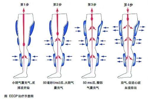 闪飞最新版，功能升级与用户体验的革新之旅